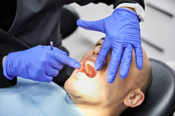 Best Emergency Tooth Extraction in Gregory, TX